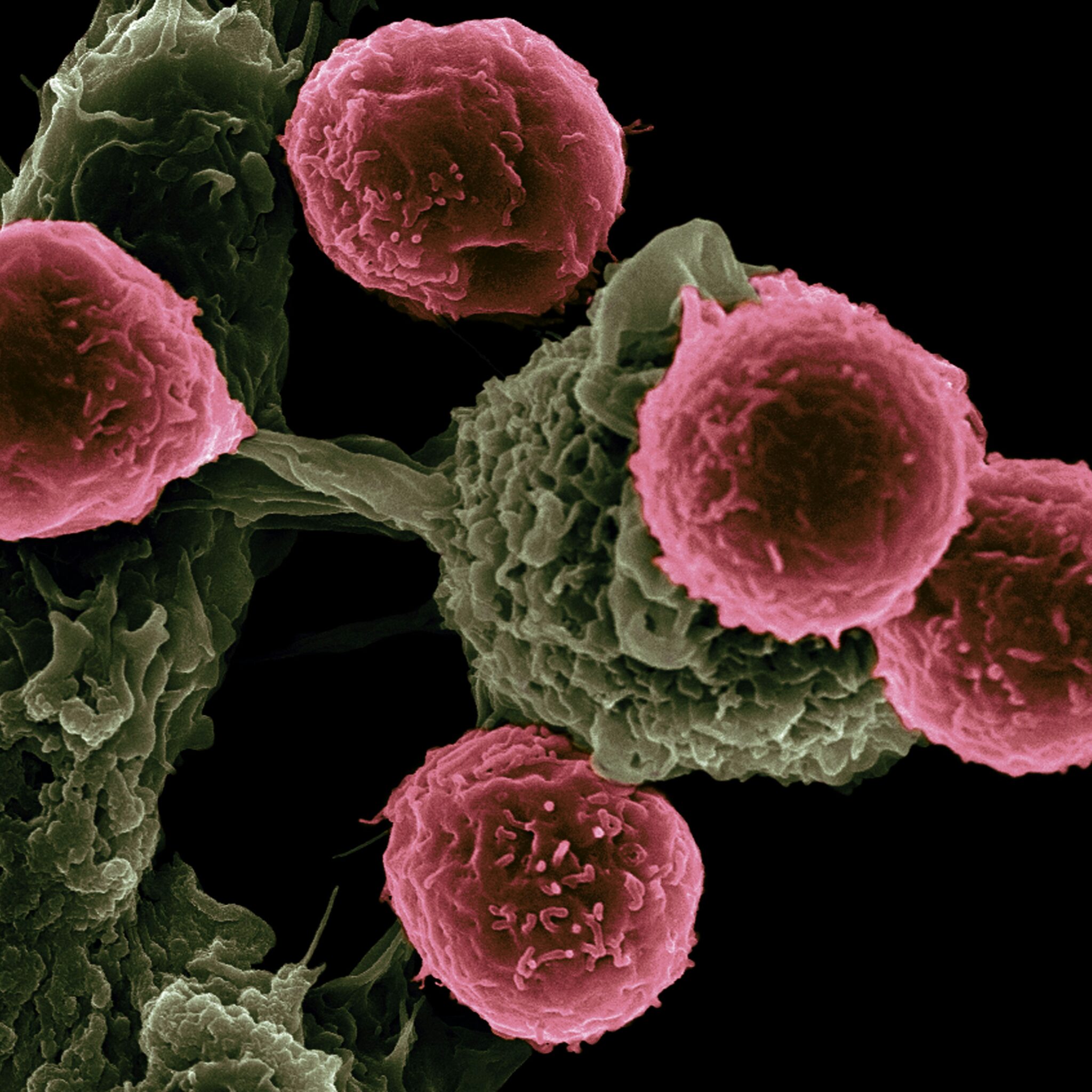 Células cancerígenas