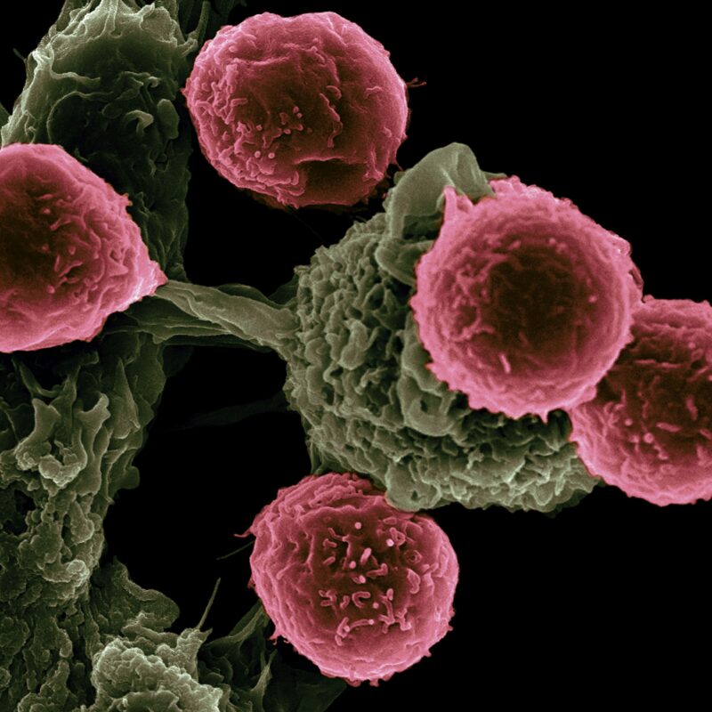 Células cancerígenas