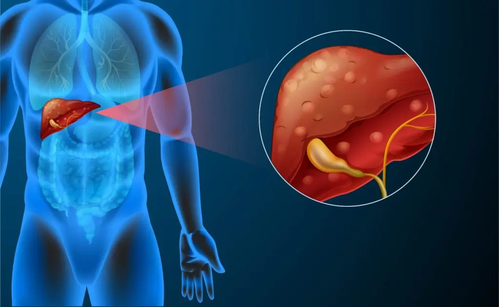 Prancheta-210figado-canc-1024x631
